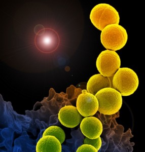 A colorized scanning electron micrograph of a white blood cell eating an antibiotic resistant strain of Staphylococcus aureus bacteria, commonly known as MRSA. (Source: National Institute of Allergy and Infectious Diseases (NIAID))