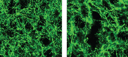 Dopamine neurons. Image credit: Witten et al., Nature Neuroscience
